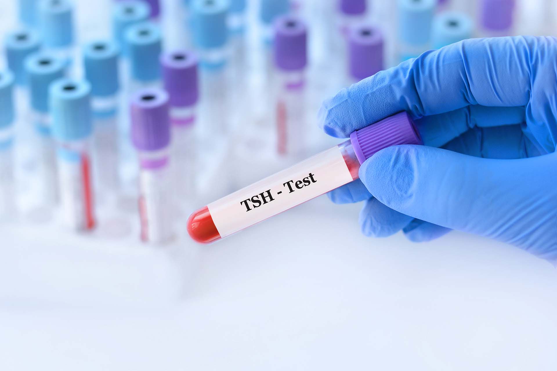 Hormone and metabolic diagnostics